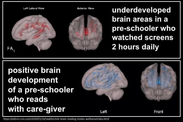 brain activity during different activities
